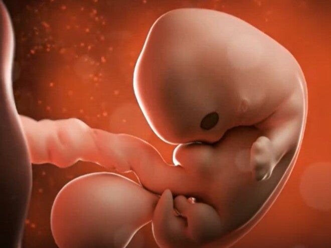 5 Weeks Pregnant video