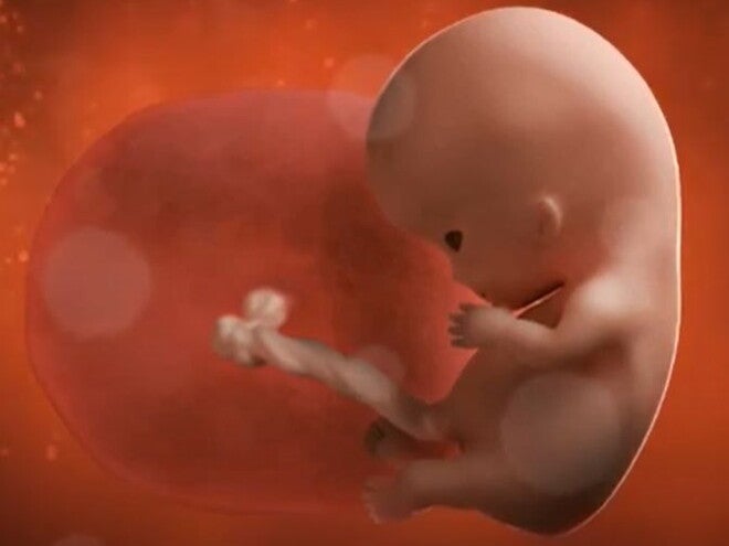 8 Weeks Pregnant video